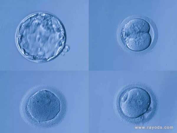 双角子宫怀孕几率_染色体异常胎停了_高龄试管养囊有什么好处,高龄试管是否应