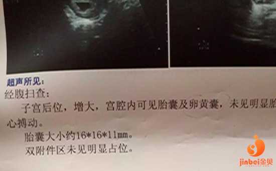 染色体异常老流产_染色体异常致胎停_有在武汉康健医院做试管婴儿的吗?怎么样