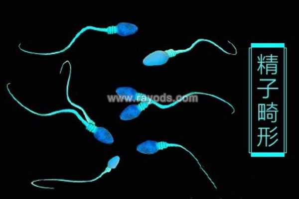 染色体异常能试管_子宫切除怎样怀孕_了解大龄男性的DFI，如何提高自己的试管