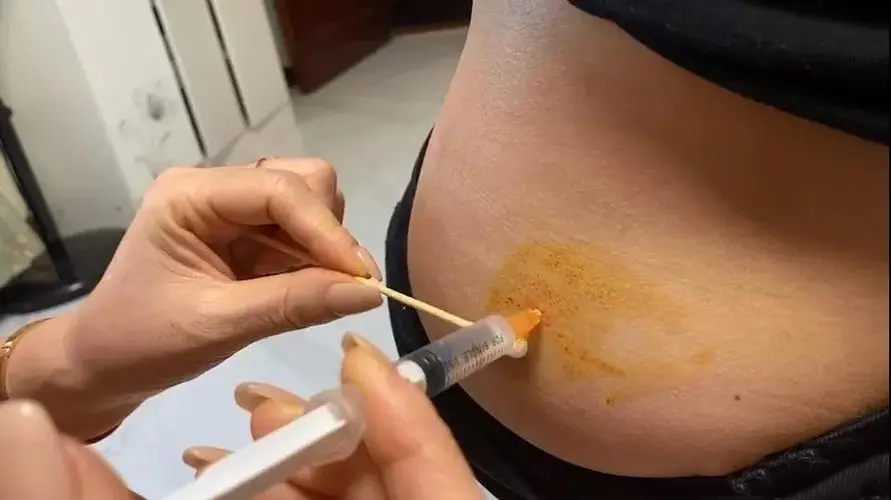 杭州合法代生小孩 杭州市滨江医院试管婴儿患者评价 ‘46*32mm孕囊是男是女’
